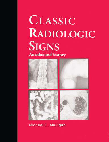 Classic Radiologic Signs An Atlas and History