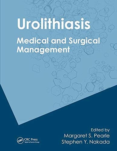 Urolithiasis Medical and Surgical Management of Stone Disease