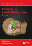 Clinical Insights for Image-guidance Radiation Therapy Prostate