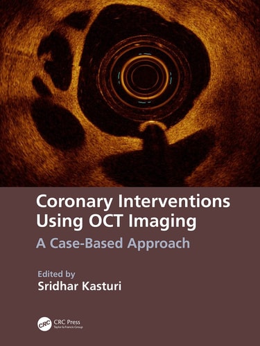 Coronary Interventions Using OCT Imaging A Case-Based Approach