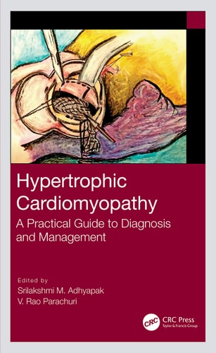 Hypertrophic Cardiomyopathy A Practical Guide to Diagnosis and Management