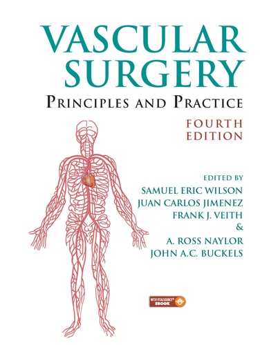 Vascular Surgery Principles and Practice, Fourth Edition