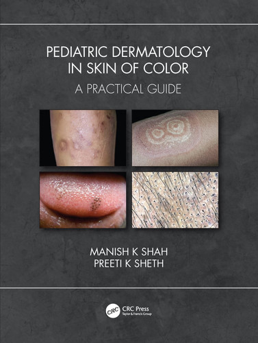 Pediatric dermatology in skin of color: a practical guide