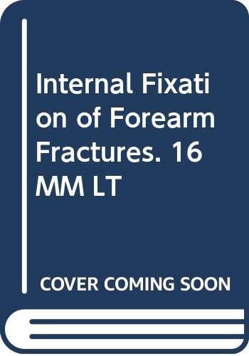 Internal Fixation of Forearm Fractures. 16 MM LT