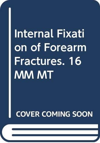 Internal Fixation of Forearm Fractures. 16 MM MT