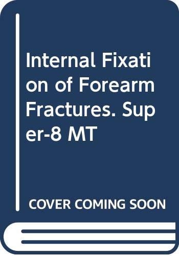 Internal Fixation of Forearm Fractures. Super-8 MT
