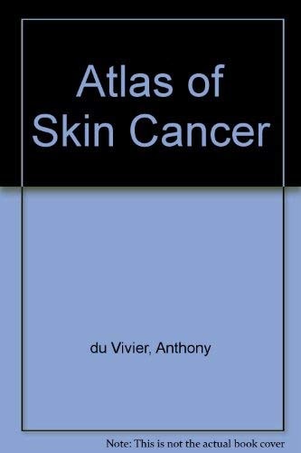 Atlas of Skin Cancer
