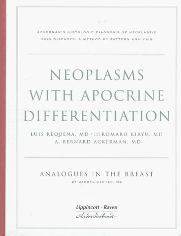 Neoplasms with Apocrine Differentiation