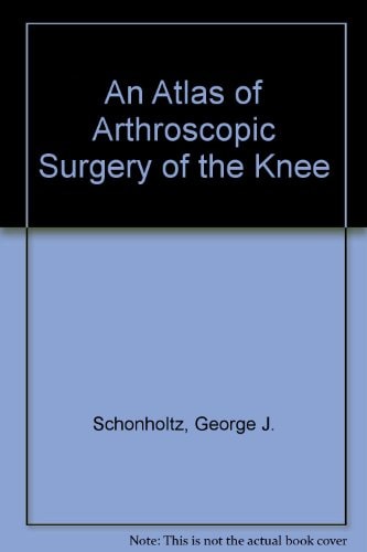 An Atlas of Arthroscopic Surgery of the Knee