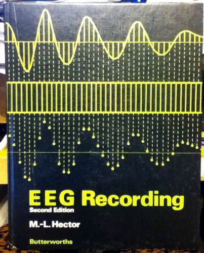 EEG Recording