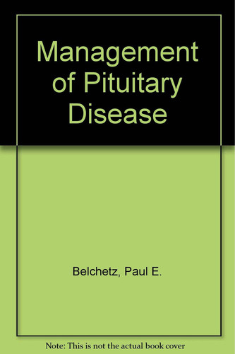 Management of pituitary disease