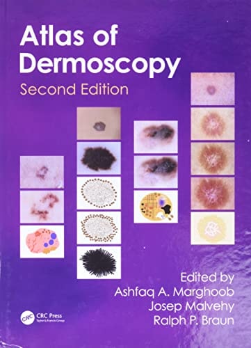 An Atlas of Dermoscopy, Second Edition