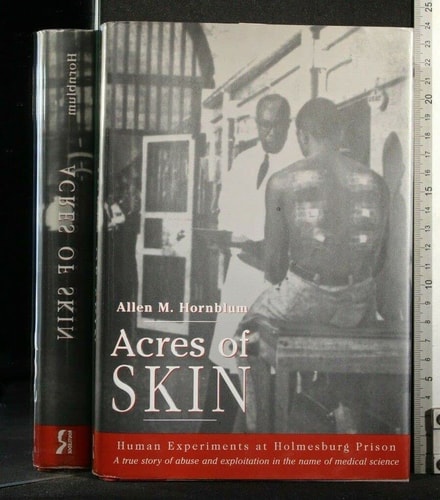 Acres of Skin Human Experiments at Holmesburg Prison : a Story of Abuse and Exploitation in the Name of Medical Science