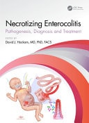 Necrotizing Enterocolitis Pathogenesis, Diagnosis and Treatment