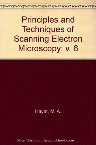 Principles and techniques of scanning electron microscopy : biological applications