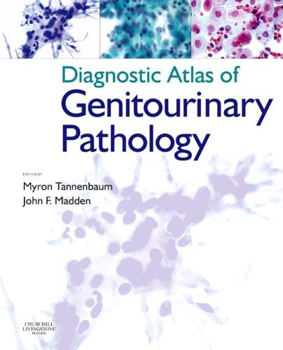 Diagnostic Atlas of Genitourinary Pathology