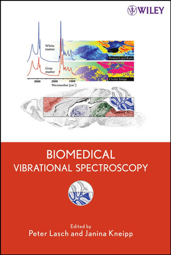 Biomedical Vibrational Spectroscopy