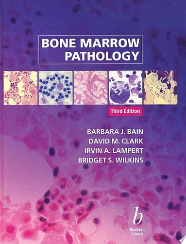 Bone Marrow Pathology
