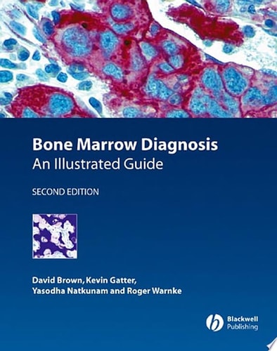 Bone Marrow Diagnosis An Illustrated Guide