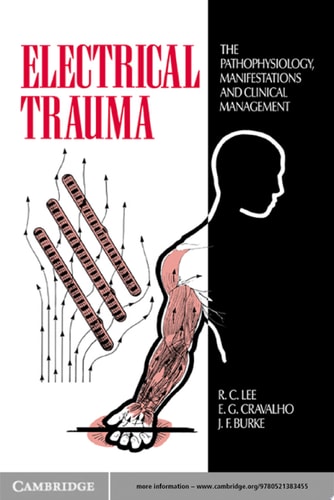 Electrical Trauma The Pathophysiology, Manifestations and Clinical Management