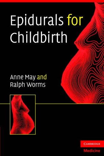 Epidurals for childbirth: a guide for all delivery-suite staff