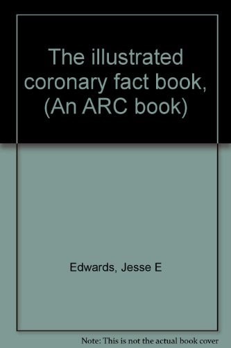 The Illustrated Coronary Fact Book