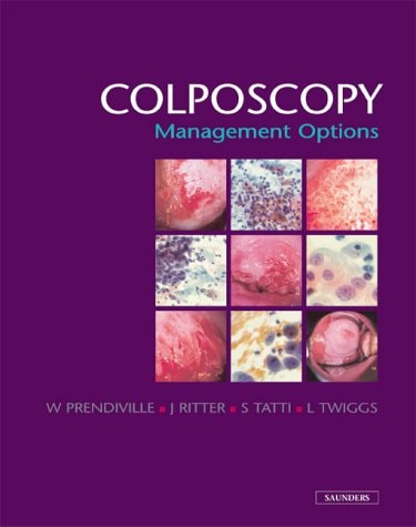 Colposcopy: Management Options