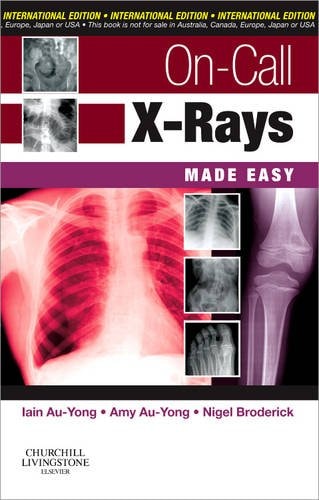 On-call X-rays Made Easy