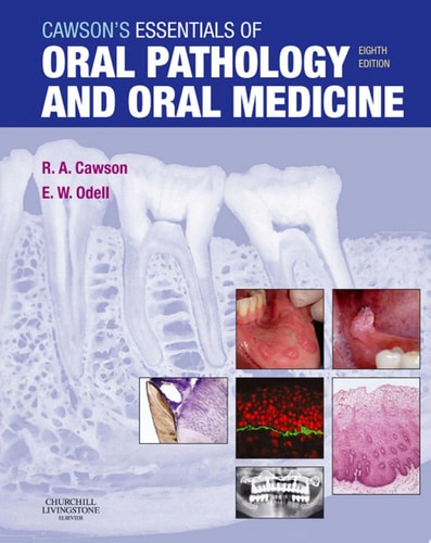 Cawson's Essentials of Oral Pathology and Oral Medicine E-Book Cawson's Essentials of Oral Pathology and Oral Medicine E-Book