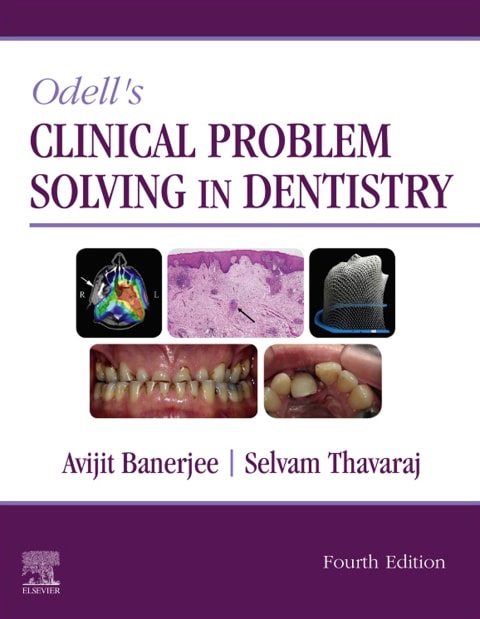 Odell's Clinical Problem Solving in Dentistry