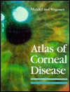 Atlas of Corneal Disease