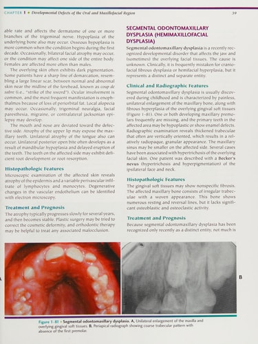 Oral & Maxillofacial Pathology