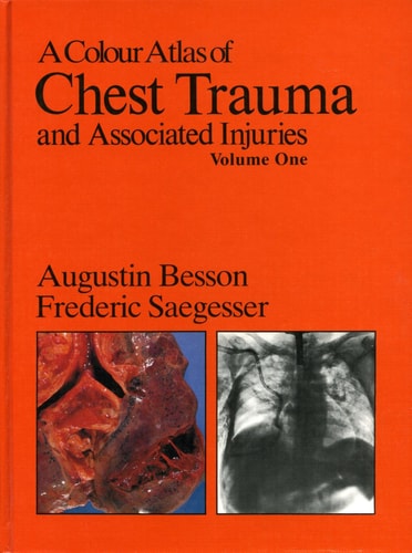 A Colour Atlas of Chest Trauma and Associated Injuries, Vol. 1 (Wolfe Medical Atlases)