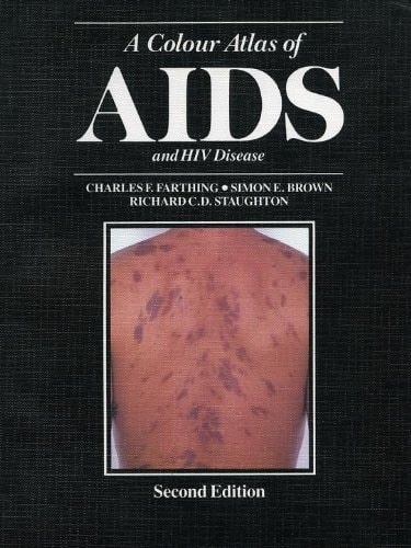 A Colour Atlas of AIDS and HIV Disease