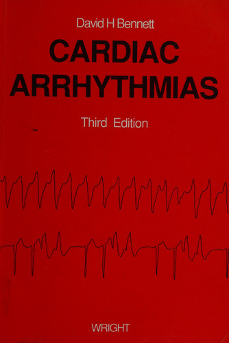 Cardiac Arrhythmias: Practical Notes on Interpretation and Treatment