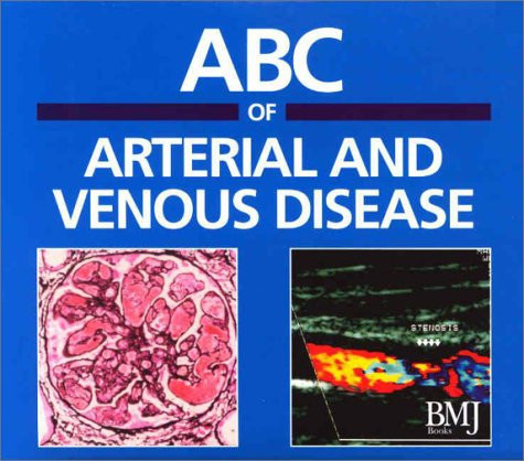 ABC of Arterial and Venous Disease