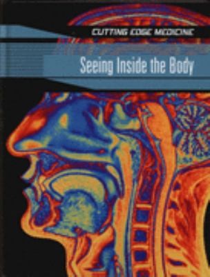 Seeing Inside the Brain