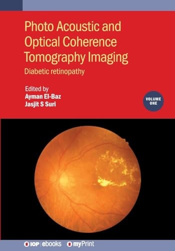 Photo Acoustic and Optical Coherence Tomography Imaging, Volume 1: Diabetic Retinopathy