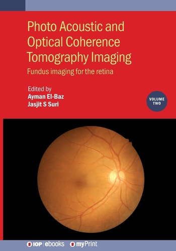 Photo Acoustic and Optical Coherence Tomography Imaging, Volume 2: Fundus Imaging for the Retina