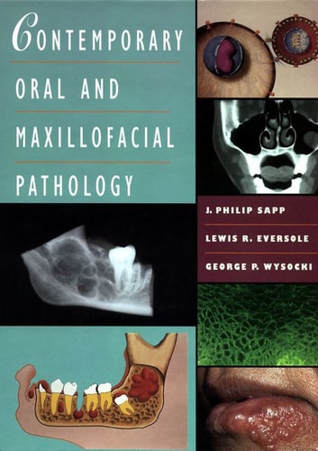 Contemporary Oral and Maxillofacial Pathology