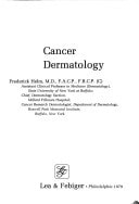 Cancer Dermatology