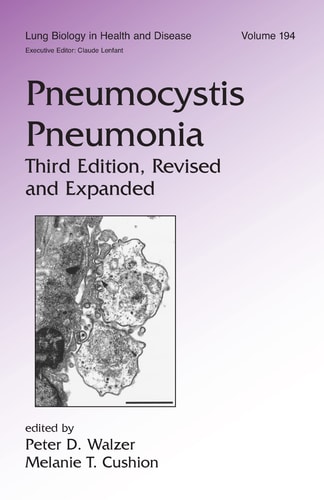 Pneumocystis Carinii Pneumonia
