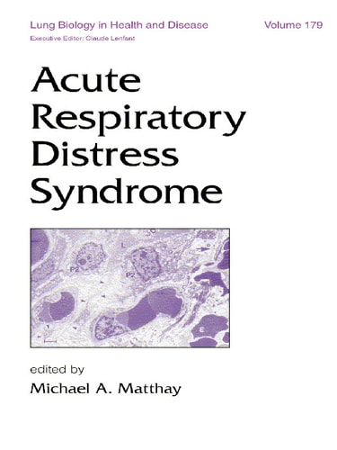 Acute Respiratory Distress Syndrome