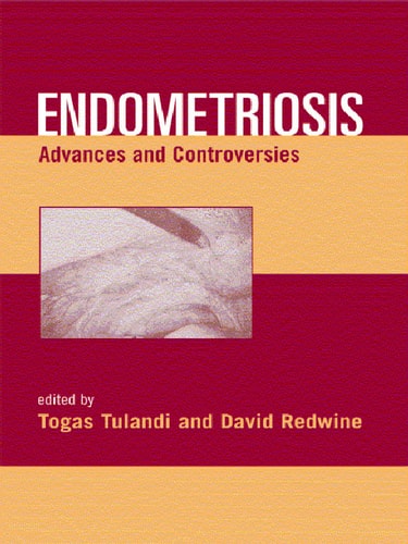 Endometriosis Advances and Controversies