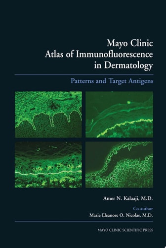 Mayo Clinic Atlas of Immunofluorescence in Dermatology Patterns and Target Antigens