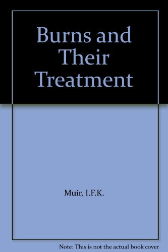 Burns and their treatment
