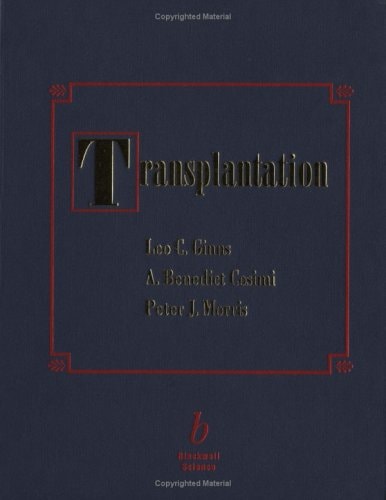 Organ Transplantation
