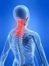 Neck Pain