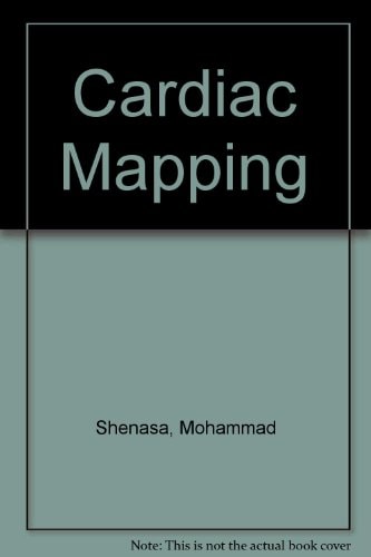 Cardiac Mapping