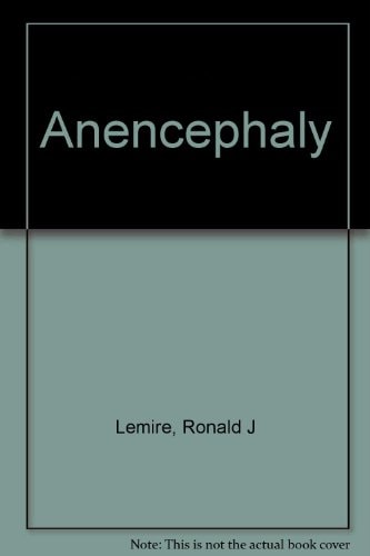Anencephaly